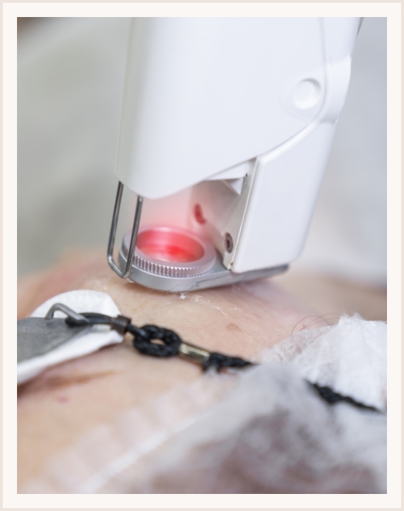 Proveedores de aparatología estética y médica 11 - Midis Laser